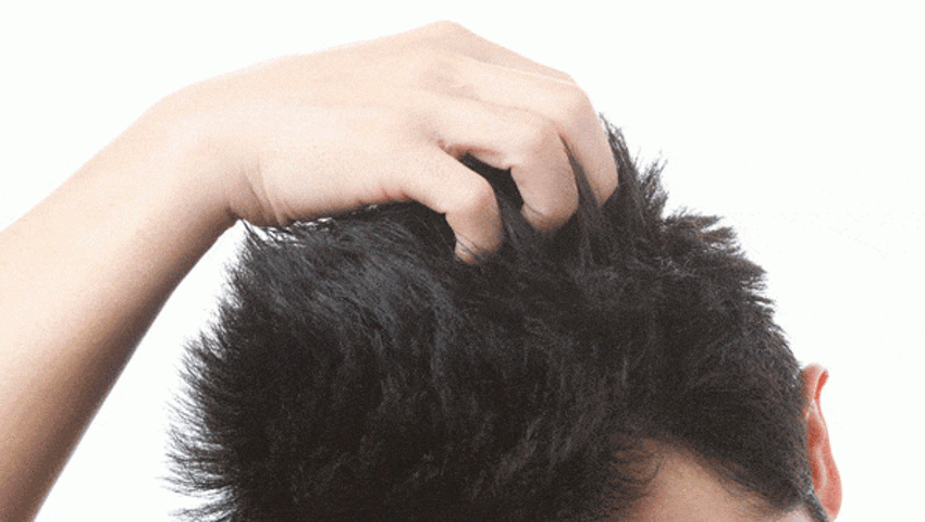Saç dipleri neden acır? Saç diplerinin ağrımasının 16 nedeni ve tedavisi