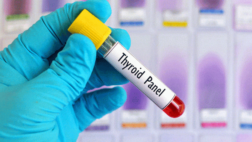 Tiroid Hormonu Yüksekliği Belirtileri, Nedenleri Ve Tedavisi