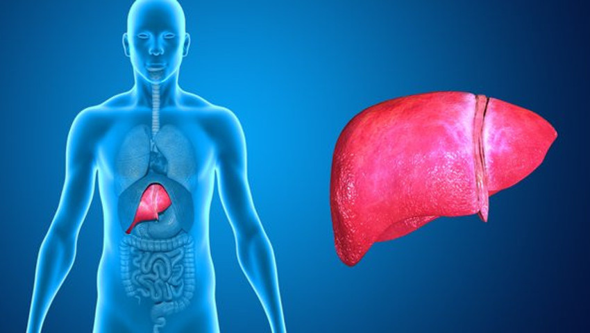 Karaciğer Kanseri Ölüm Belirtileri Tedavisi Mümkün mü Kurtulan Var mı?