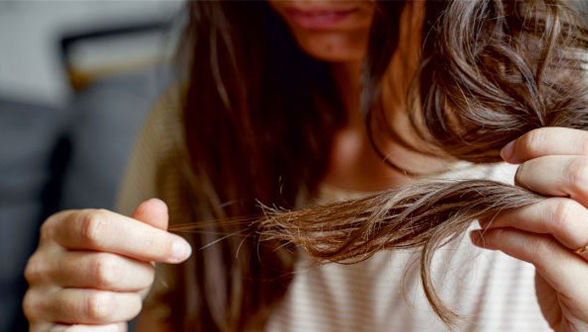 Harvard Üniversitesi bilim insanlarının yeni keşfi: Stres saç dökülmesi yapıyor