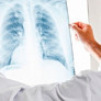 Akciğerdeki Nodül Geçermi Öksürük Ağrı Kanser Yaparmı Tehlikeli midir?