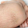 Bebeklerde konak nasıl geçer? Zeytinyağı, karbonat, badem yağı… en etkili doğal çözümler