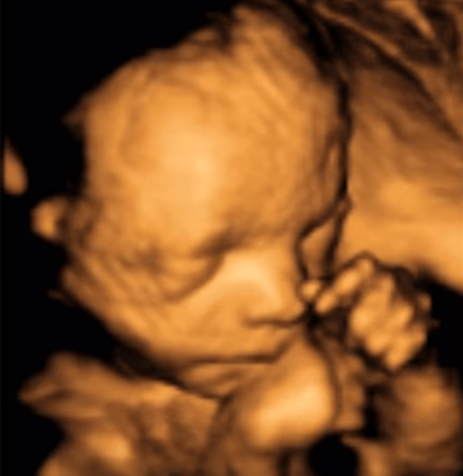 23 haftalik gebelik bebek kilosu goruntusu gelisimi 23 haftalik hamileyim