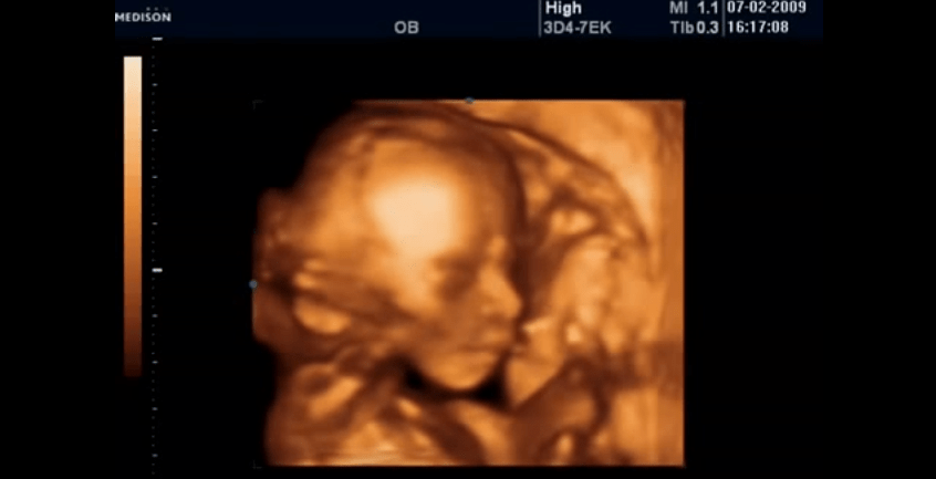 22 haftalik gebelik bebek kilosu boyu gelisimi goruntusu