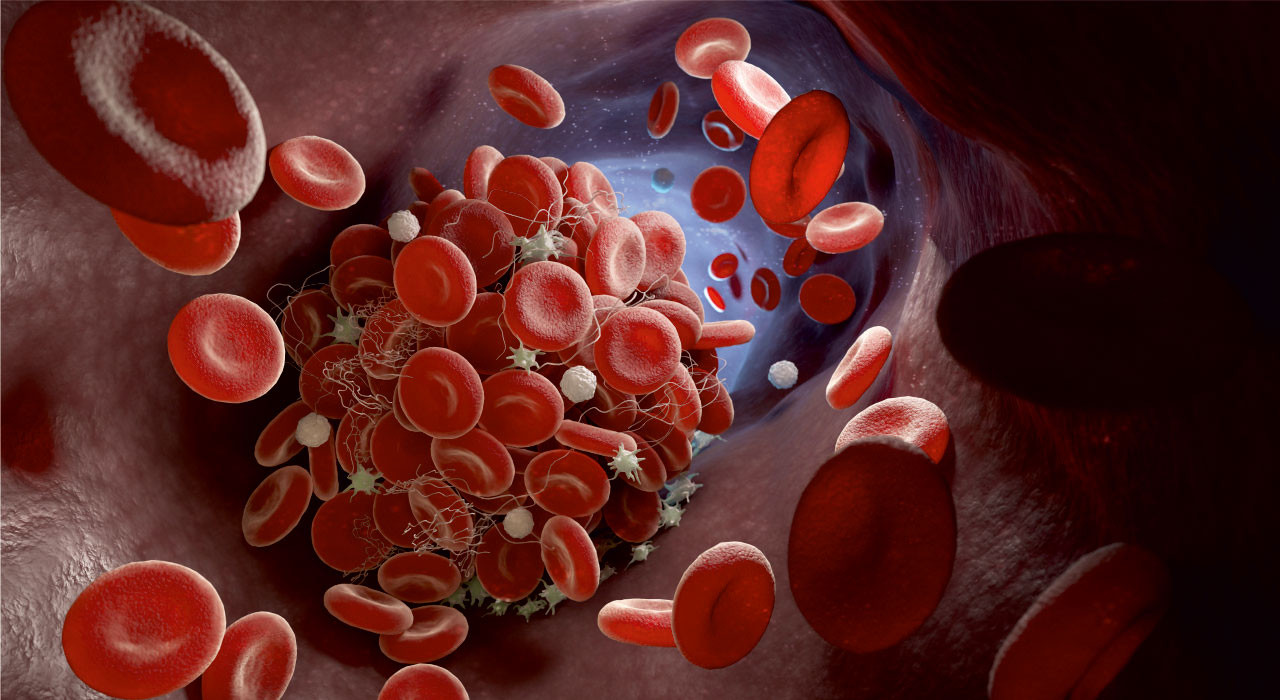 yüksek tansiyon için kırmızı kan hücreleri