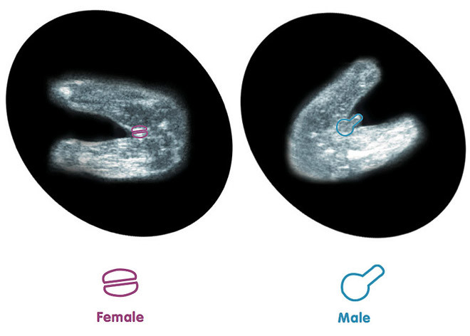 erkek bebek ultrasonda nasil gorunur ultrasonda erkek bebek belirtileri