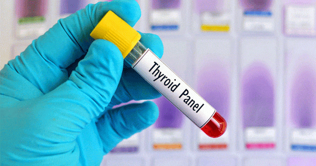 Tiroid Hormonu Yüksekliği Belirtileri, Nedenleri Ve Tedavisi