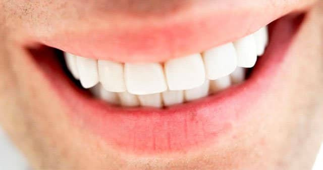 Anında Diş Beyazlatma, Dişteki Sigara Lekeleri Nasıl Geçer?
