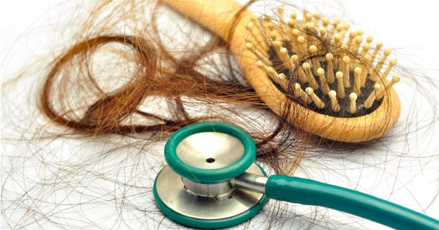Aşırı Saç Dökülmesinin Nedenleri Neler Ne İyi Gelir Nasıl Önlenir