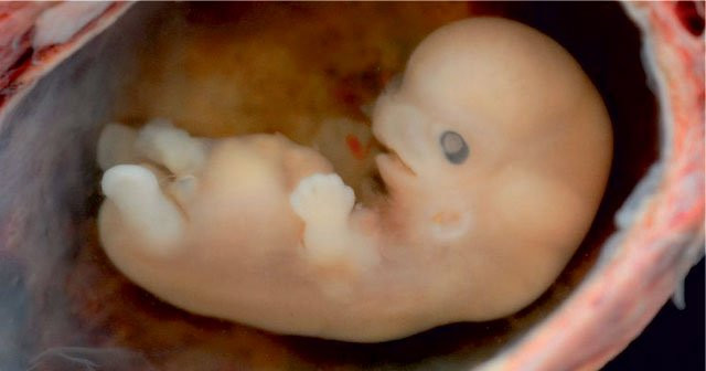 morfin yavrular acikca bebek var kalp atisi yok sudecicekcilik net
