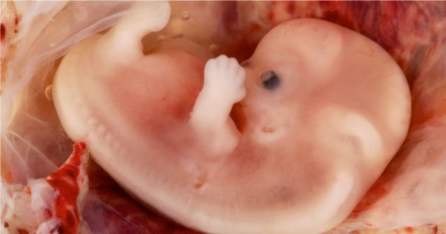 7 Haftalık Bebek Kaç mm Olur Ultrason Görüntüsü Nasıl ve Kaç Aylıktır