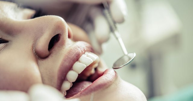 20 lik diş çekimi sonrası çabuk iyileşmek için dikkat edilmesi gerekenler