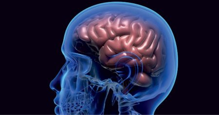 Alzheimer hastalığı beyinde küçülme yapıyor! Beyinde küçülme neden olur?