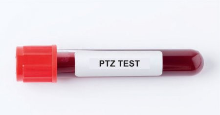 PTZ nedir? PTZ normal değeri kaç olmalıdır? PTZ testi neden yapılır?