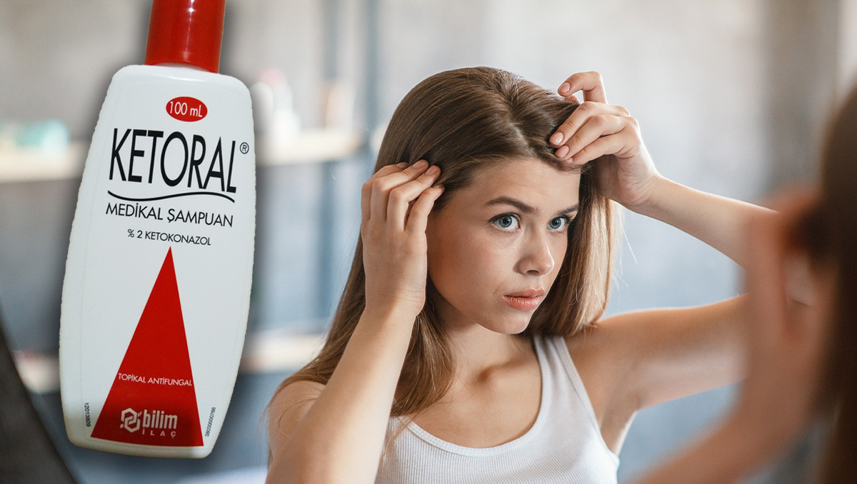 Ketoral şampuan ne işe yarar? Yan etkileri var mı? Saç kaşıntısına iyi gelir mi?