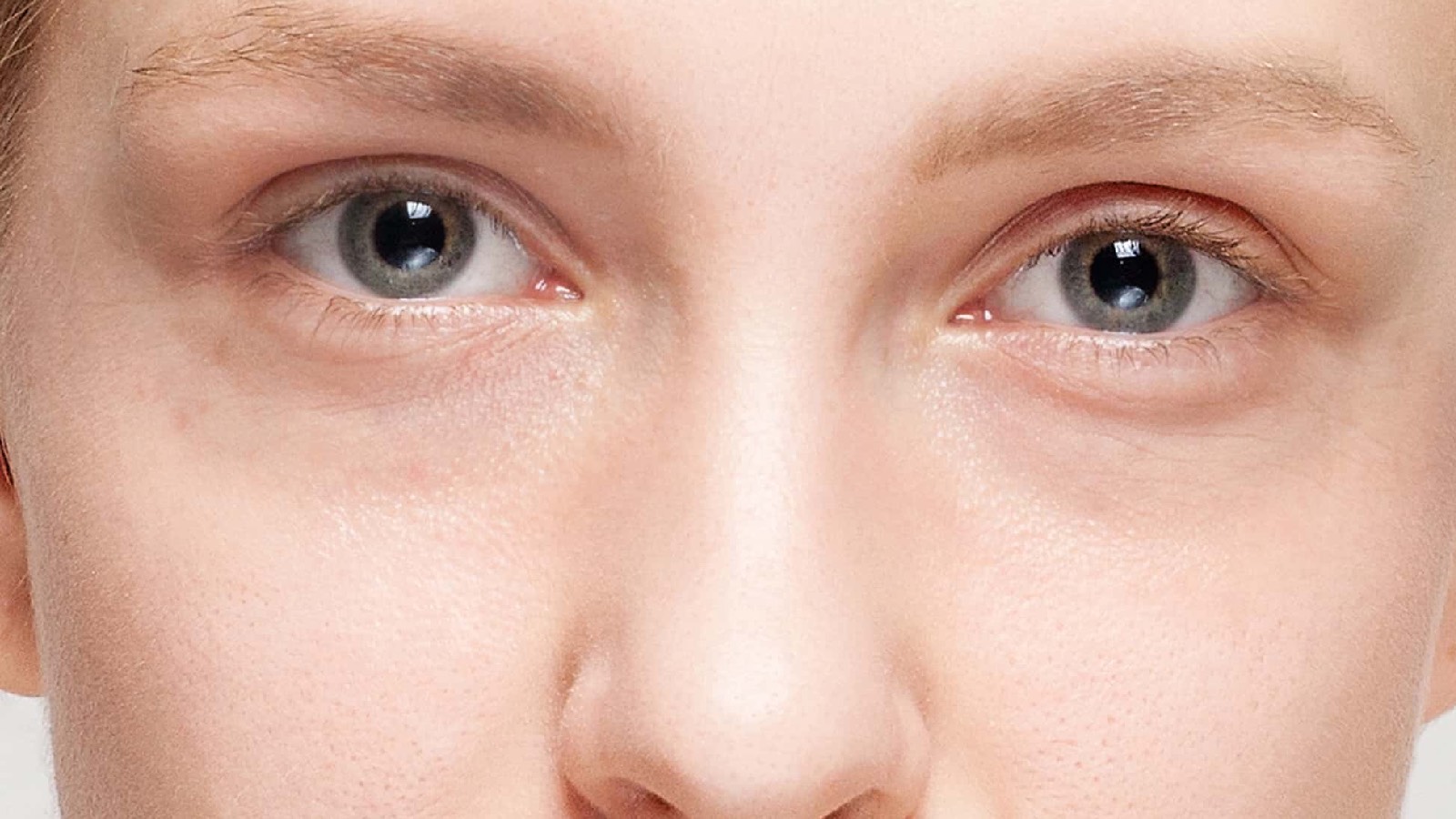 Göz altı halkaları neden oluşur? İşte en yaygın 7 nedeni