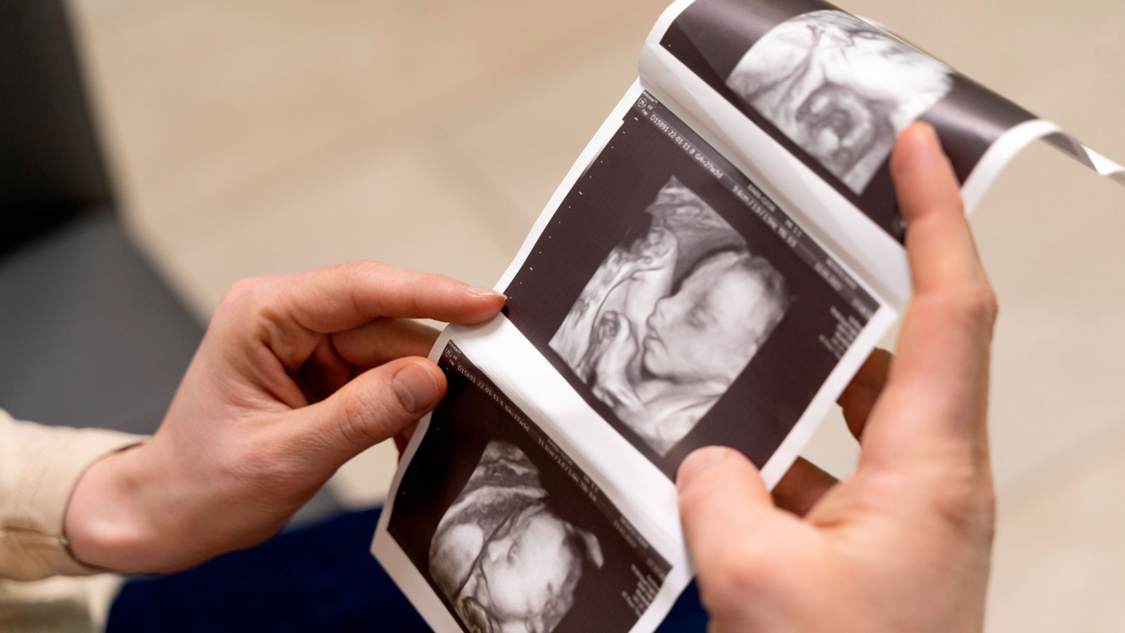 Hamilelikte 13 haftalık bebeğin görüntüsü ultrason sayesinde görülebiliyor.