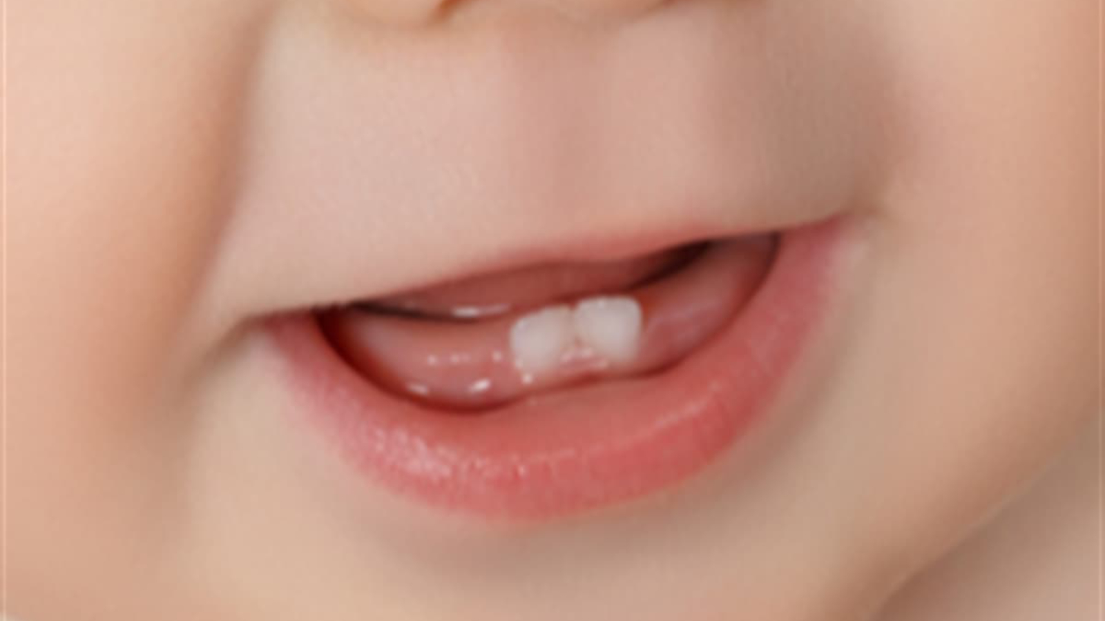 Süt diş deyip geçmeyin! Çocuğunuzun hayatını kurtaracak 9 adım