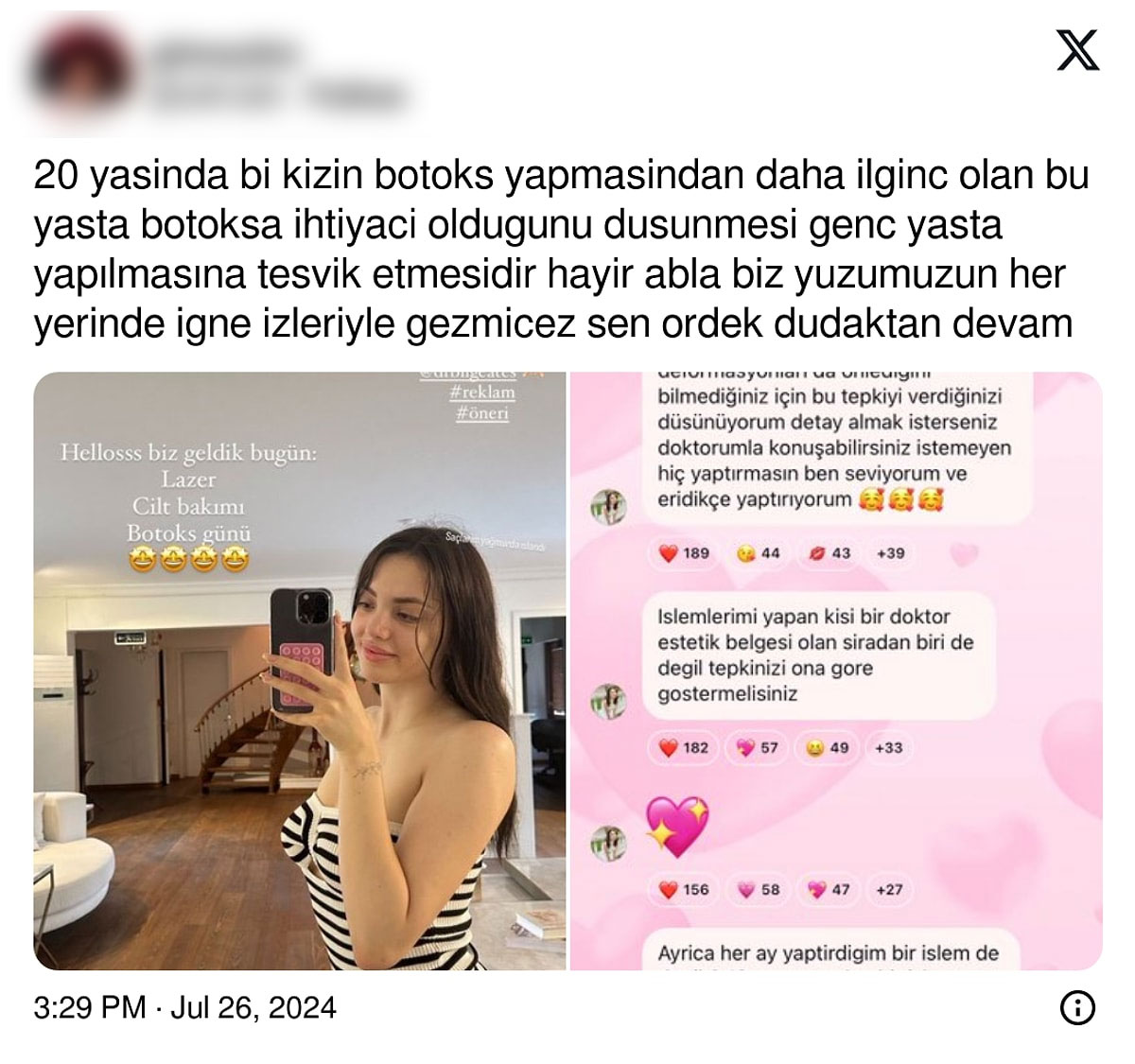 'Botoks ilaçtır' dedi sosyal medya karıştı: Elif Nur Yel eleştirilerin hedefi oldu